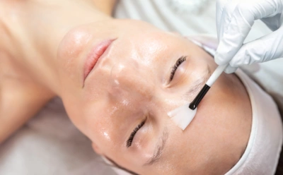 Не каждая кожа готова к такому: пилинг Джесснера дает результат, но требует особой подготовки