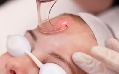Лазер убирает не только акне: какие эффекты дает чистка и все об ограничениях