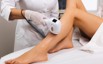 Что важно знать перед лазерной эпиляцией: как работает метод и почему нужен курс процедур