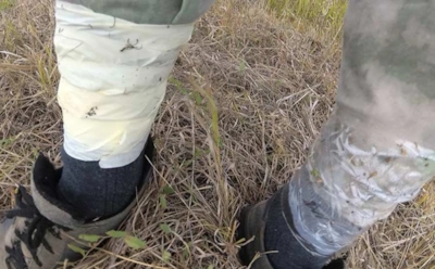 Самая неочевидная защита от клещей: как превратить обычный скотч в барьер для опасных кровососов