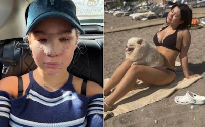 Дана Борисова рассказала, как 18-летняя дочь изуродовала себя пластикой: "Все искусственное"