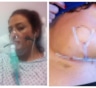 46-летней британке по ошибке удалили грудь в больнице