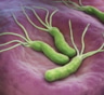 Ученые: инфекция, вызванная бактерией H. pylori, провоцирует рак