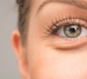 Генетика или образ жизни: что на самом деле стоит за мешками под глазами