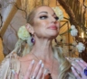 Волочкова нарушила запрет врачей и получила травму: балерина показала почерневшую ногу
