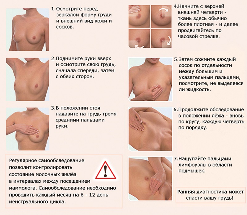 Рак груди - как определить Рак груди - как определить