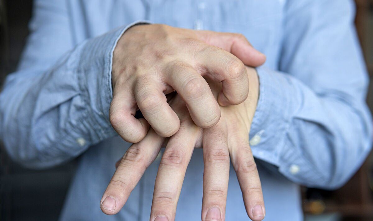 Трещины и шелушение на руках пройдут быстро: доступные рецепты без кремов и масок