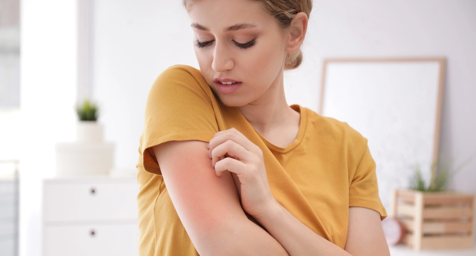 Если кожа чешется, а сыпи нет: эти внутренние сбои могут вызвать зуд без высыпаний