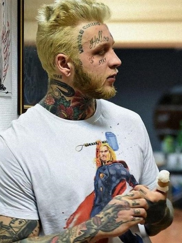 Денис шальных после удаления тату