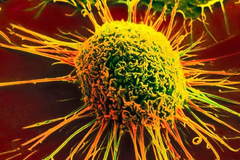 Картинка раковая клетка