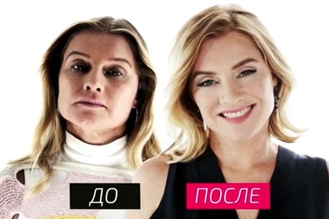 Галина Данилова до и после пластики в программе «На 10 лет моложе»