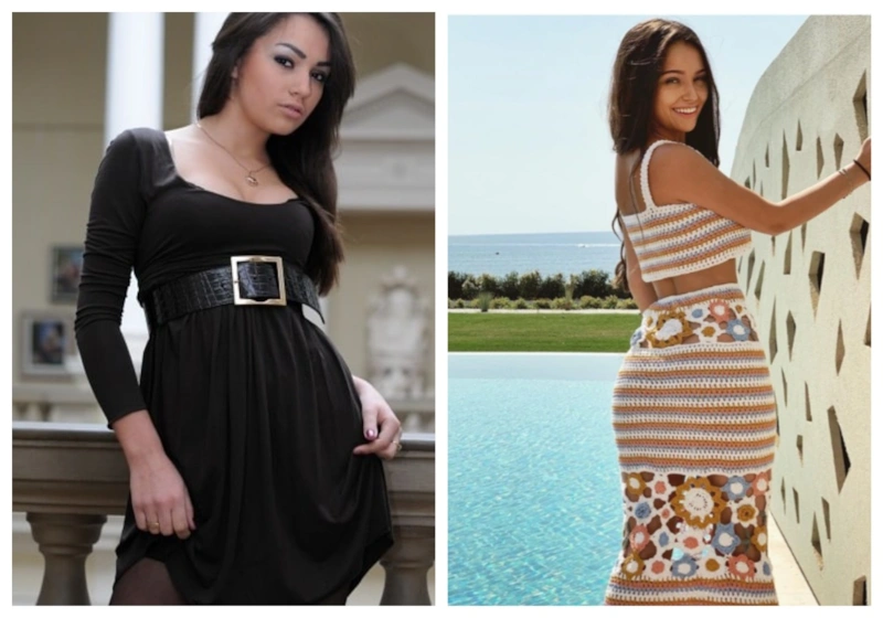 Мария Мельникова: до и после пластики