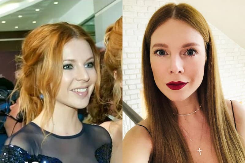 Наталья Подольская до и после ринопластики