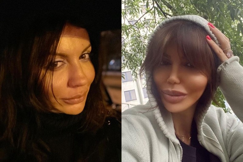 Alisa Kazmina Arshavina Biografiya Lichnaya Zhizn Foto Novosti Eks Zhena Andreya Arshavina Instagram Bolezn Operaciya 2021 24smi