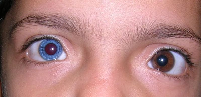 Почему и когда меняется цвет глаз у младенцев?