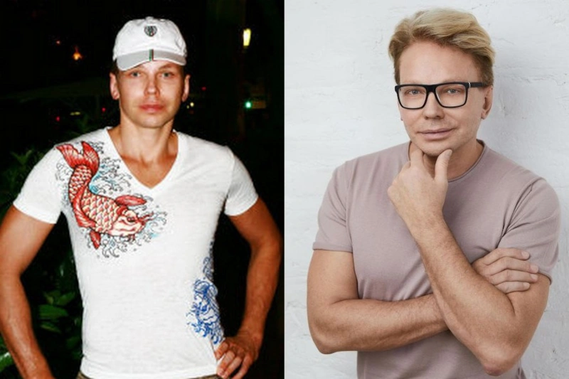 Эдгар Шабанов до и после пластики