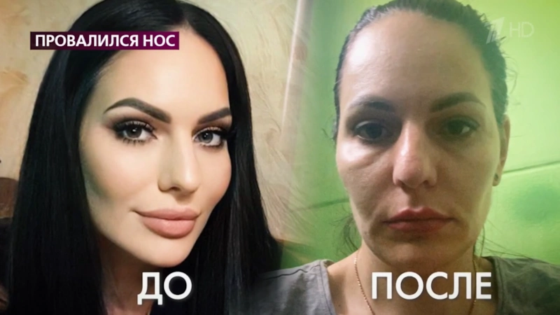 Жертва косметолога Тамара Кормишина Жертва косметолога Тамара Кормишина