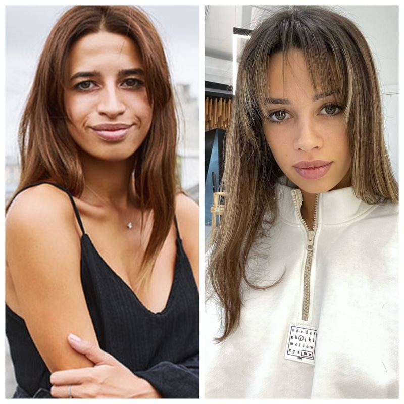 Самира Мустафаева до и после пластики