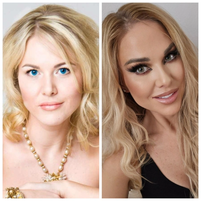 Мася Шпак до и после пластики Мася Шпак до и после пластики