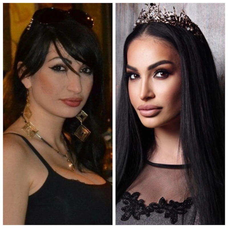 Алина Ян до и после пластики