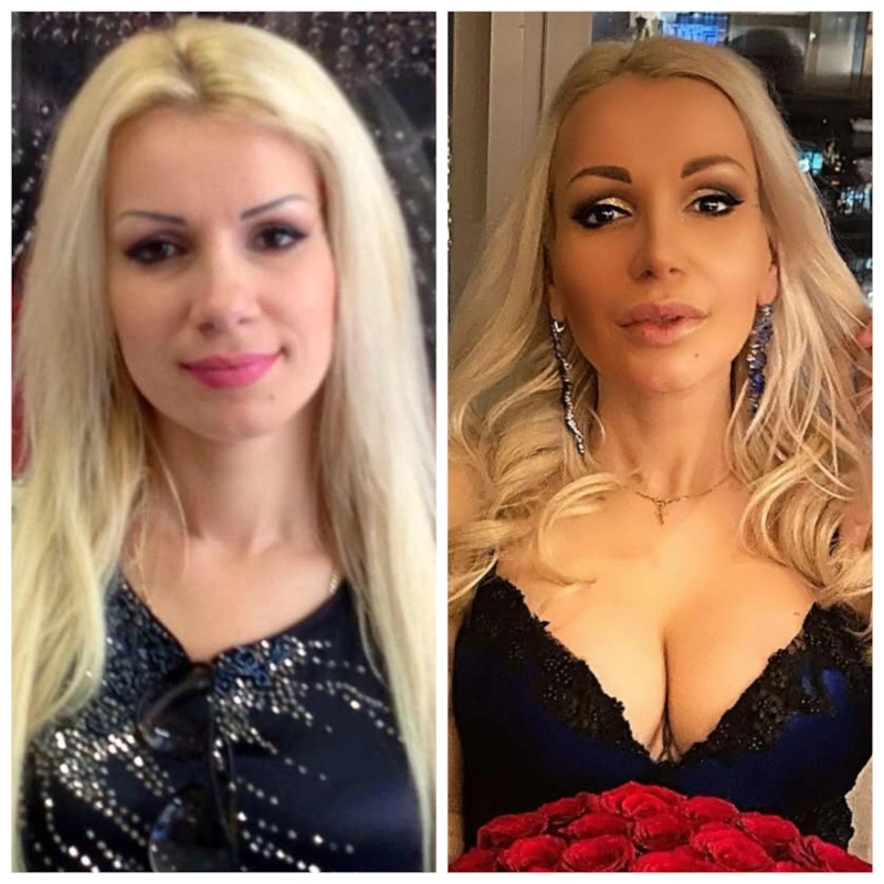 Катя Король до и после пластики Катя Король до и после пластики