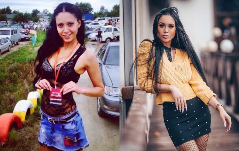 Юлия Белая до и после пластики