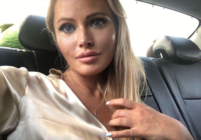 Дана Борисова показала лицо через месяц после пластики