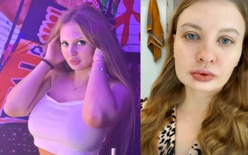 Невестка Наташи Королёвой сделала пластическую операцию Невестка Наташи Королёвой сделала пластическую операцию