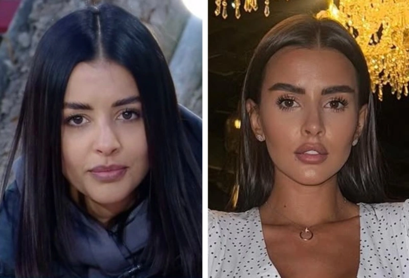 Кристина Бухынбалтэ до и после пластики