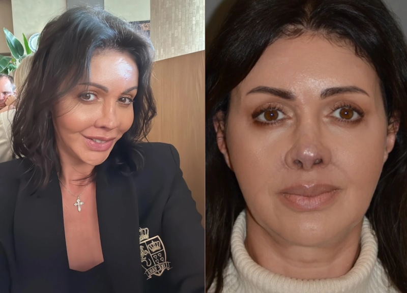 Алиса Аршавина вернула лицо после потери носа