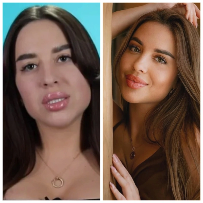 Евгения Дорожкина до и после пластики Евгения Дорожкина до и после пластики