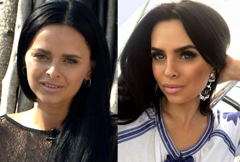 Виктория Романец до и после пластики Виктория Романец до и после пластики
