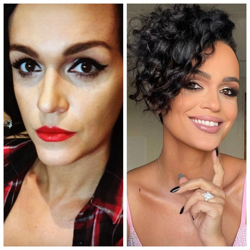 Слава до и после пластики Слава до и после пластики