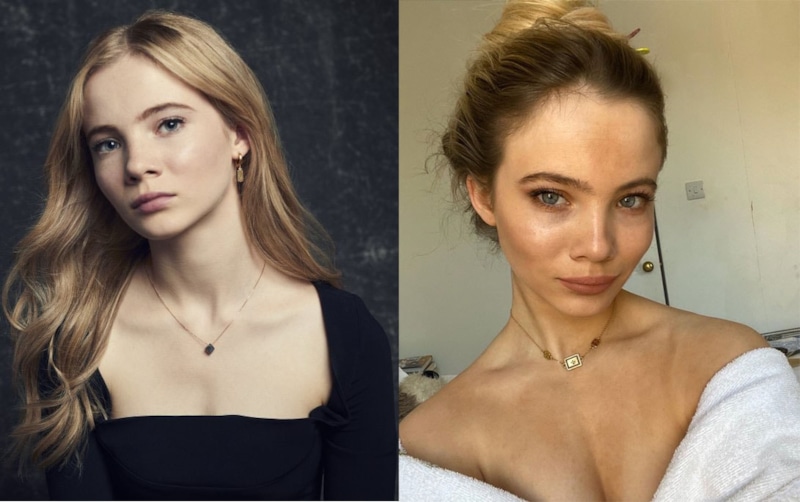 Фрейя Аллан до и после пластики