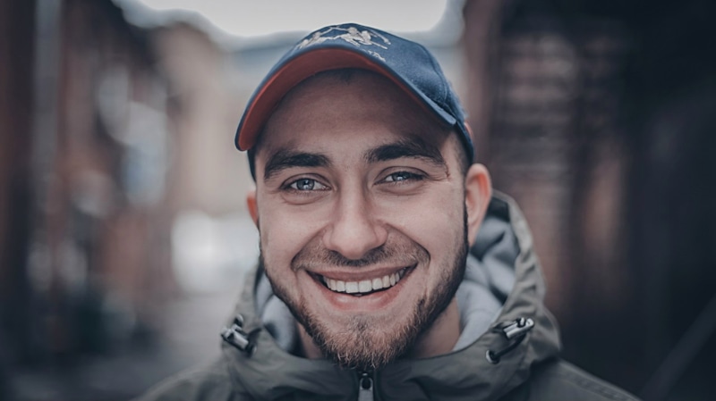 Звезде рэпа Гарри Топору сделали уникальную операцию на мозге