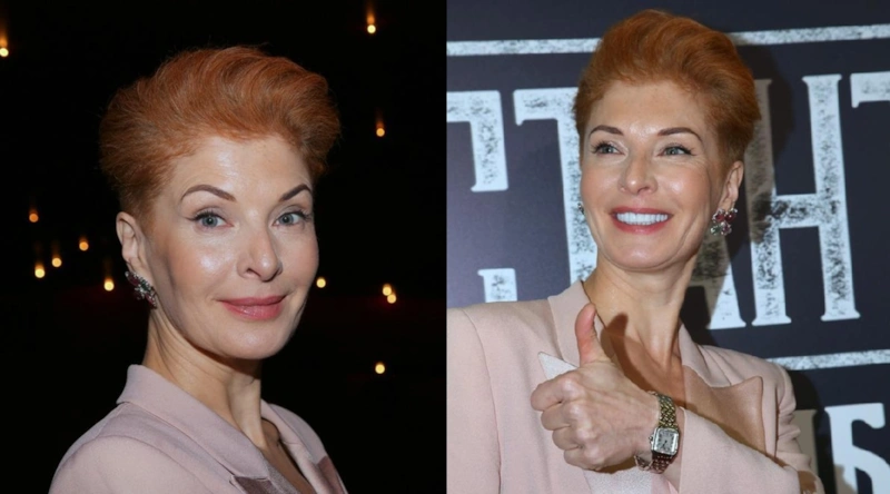 Свежие фото Амалии Мордвиновой после пластики Свежие фото Амалии Мордвиновой после пластики