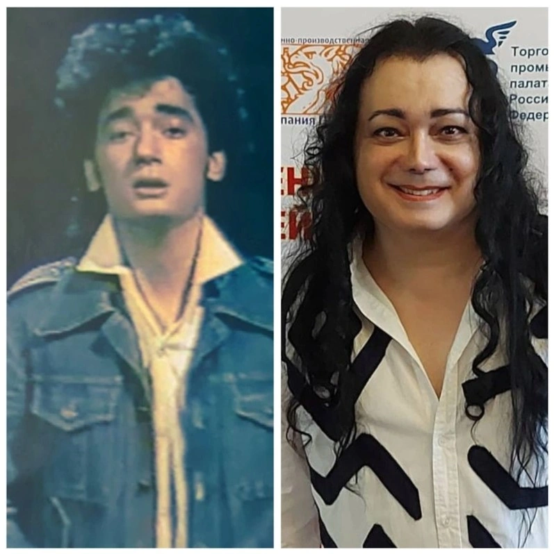 Игорь Наджиев до и после пластики