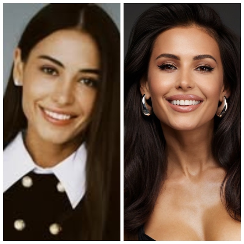 Яна Сапета до и после пластики Яна Сапета до и после пластики