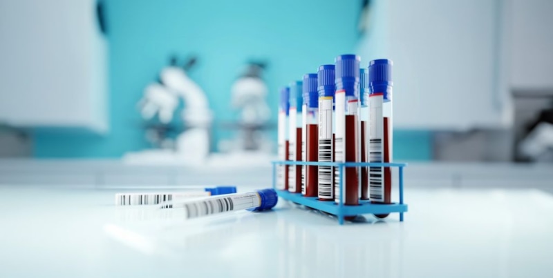 Тихая подготовка к анализам: точность растет