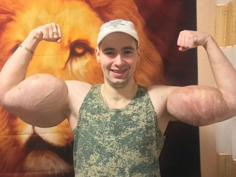 Кириллу «Руки-Базуки» грозит смертельная опасность