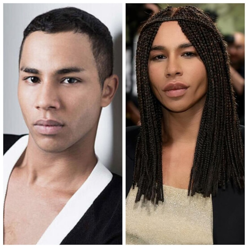 Оливье Рустен до и после пластики Оливье Рустен до и после пластики