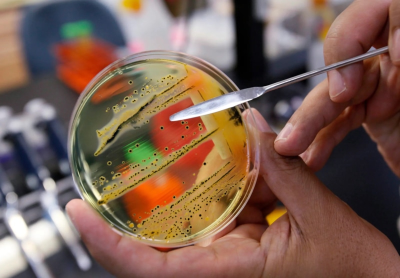 Безопасная кухня: защита от бактерий