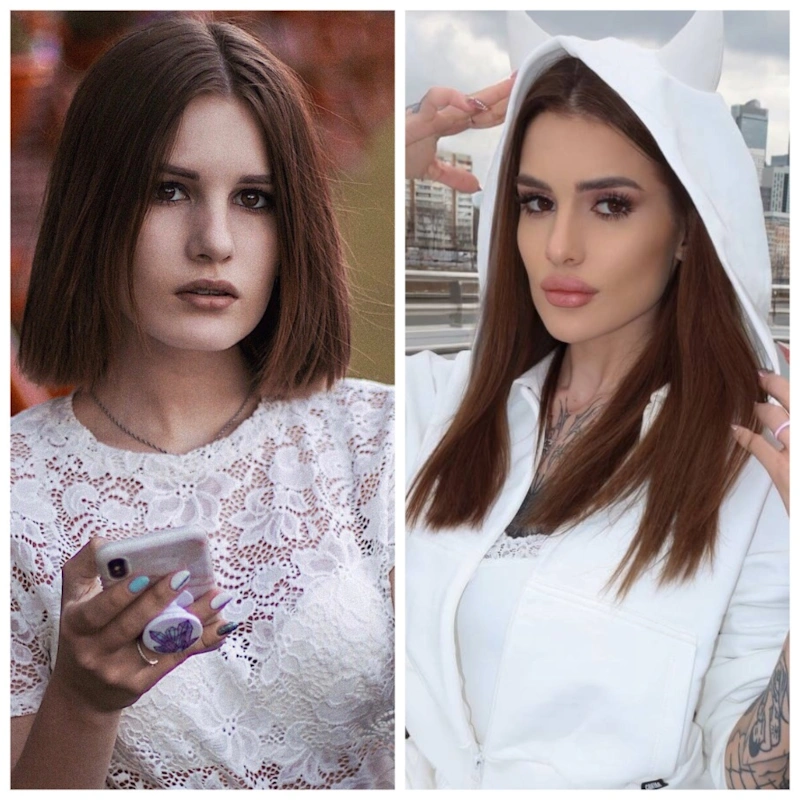 Карина Аракелян до и после пластики