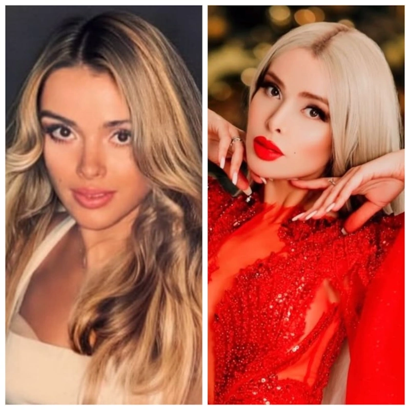 Алена Кравец  до и после пластики