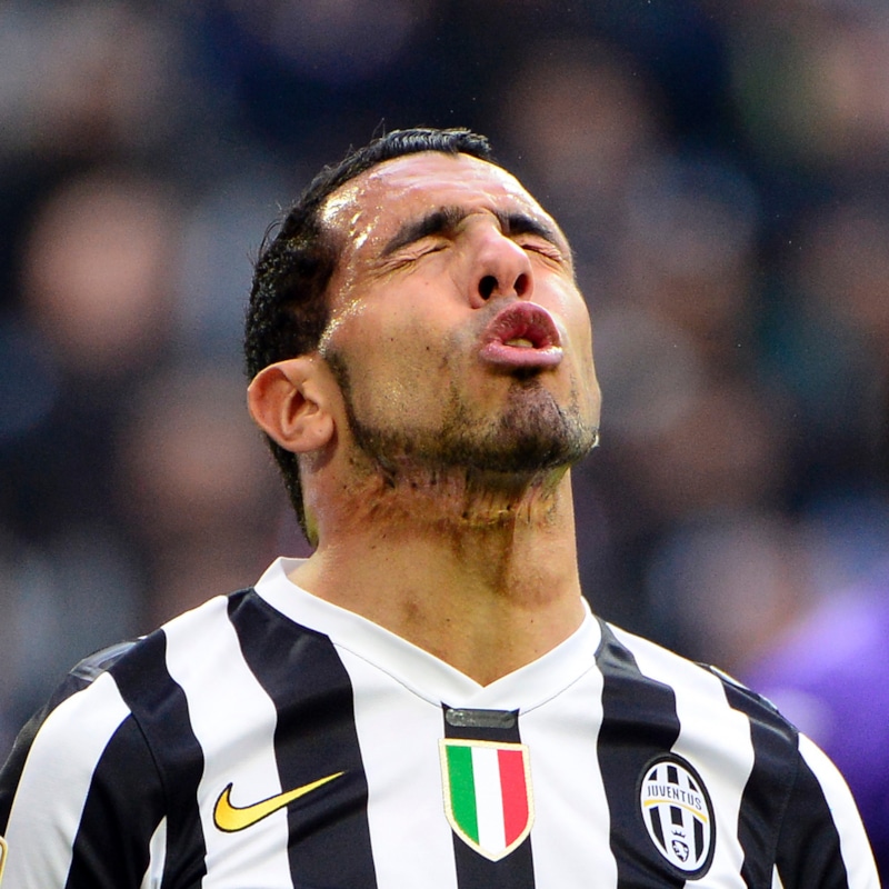 Шрам на шее у Карлоса Тевеса