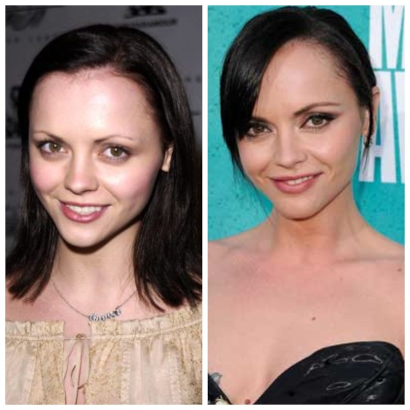 Кристина Риччи до и после пластики