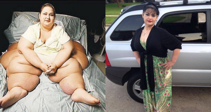 Майра Розалес до и после похудения Майра Розалес до и после похудения