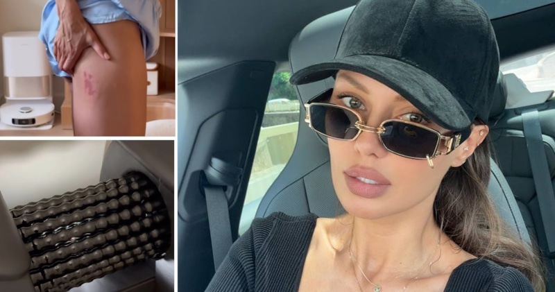 Виктория Боня травмировалась во время антицеллюлитной процедуры