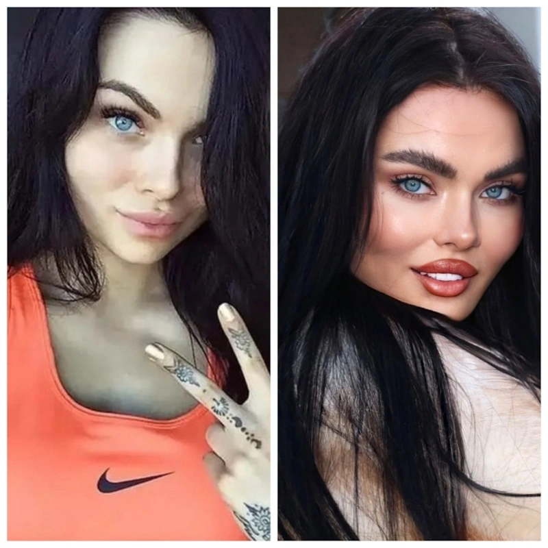 Камила Смогулецкая до и после пластики