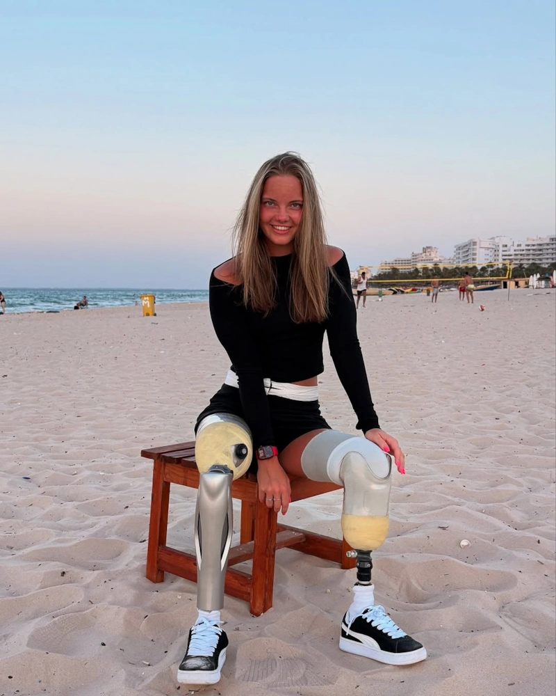 Дарья Соколова без ног после аварии